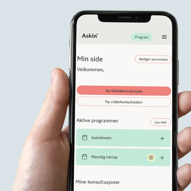 Smarttelefon viser Askin sin 'Min side' der brukere enkelt kan laste opp medisinske bilder og blodprøveresultater.