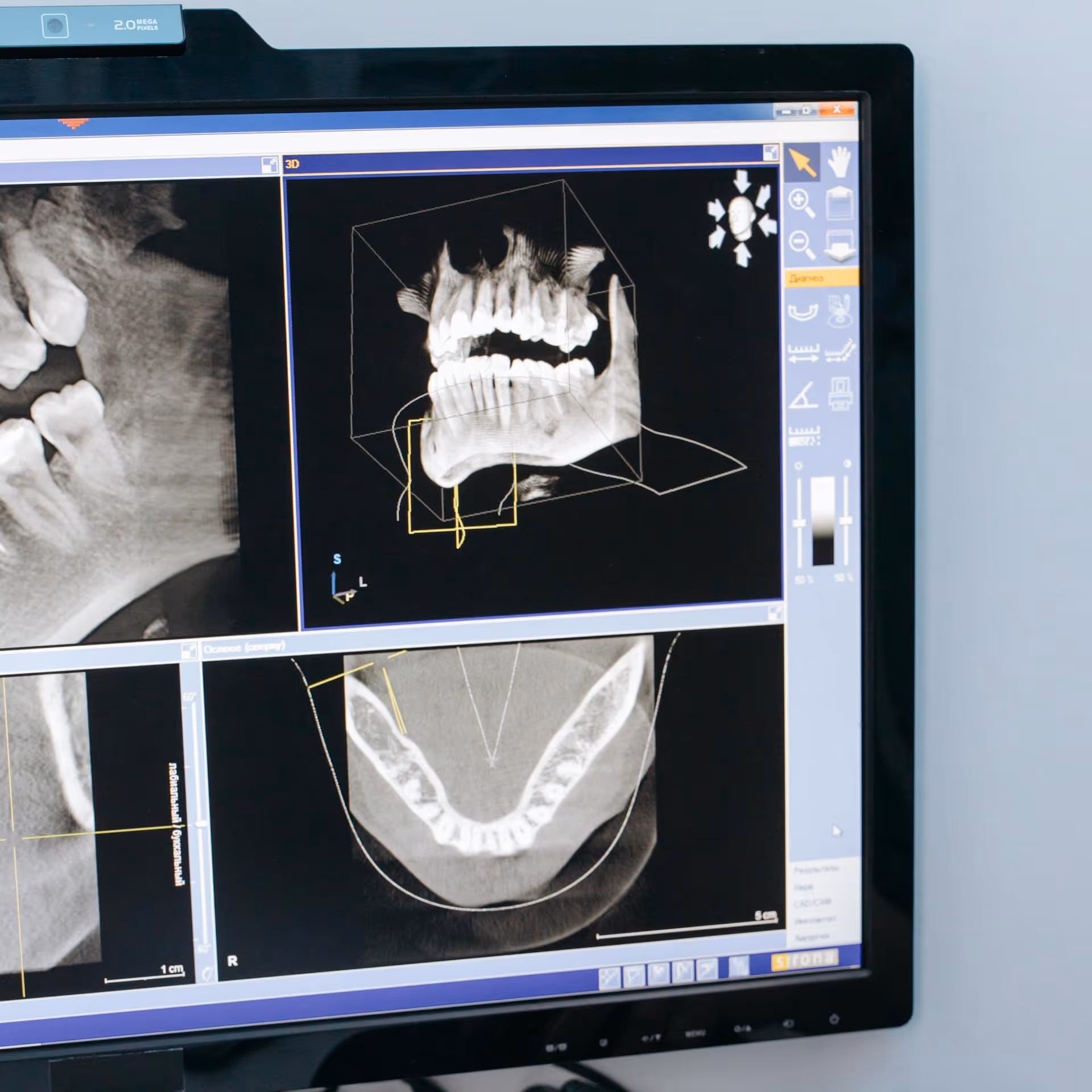 Computer screen displaying 3D and cross-sectional dental X-ray images of a human jaw and teeth.