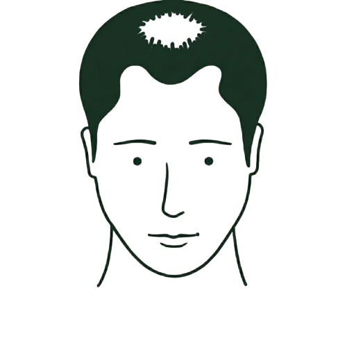 Outline of a man's head with a jagged hole at the top symbolizing a brain or mind gap.