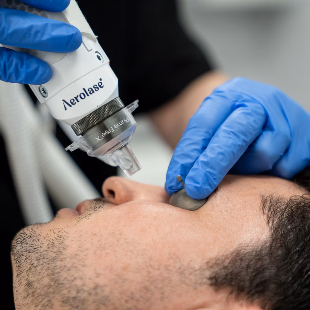 A patient being treated with the Aerolase Era laser with Hybrid Fractional lens