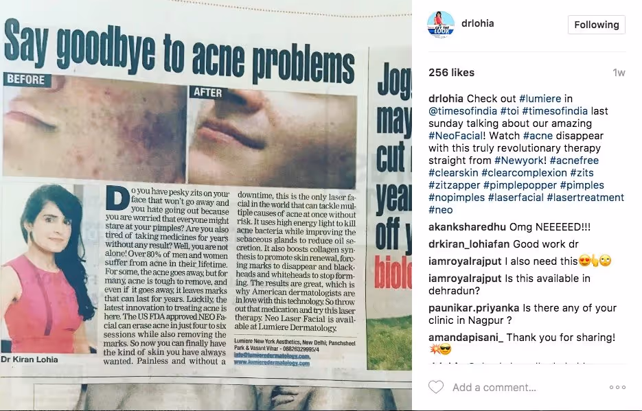 Acne has met it's match with the neo elite laser