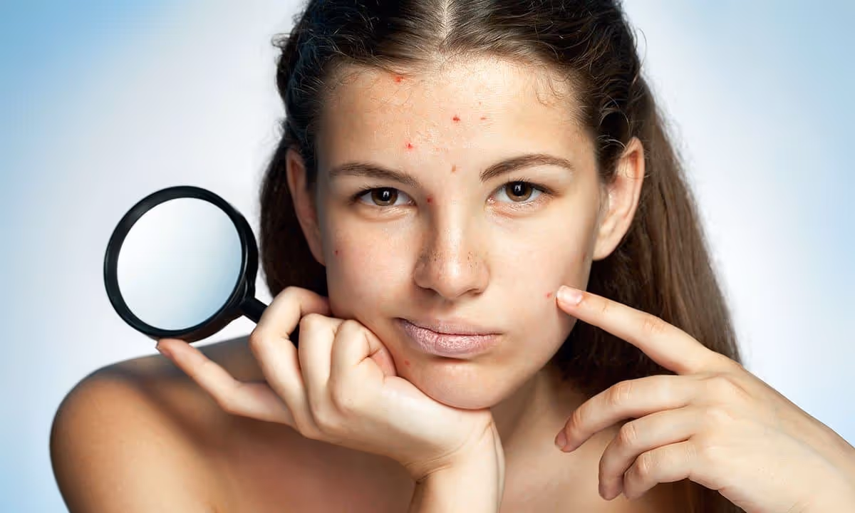 The correlation between school sports and acne flare ups is very apparent