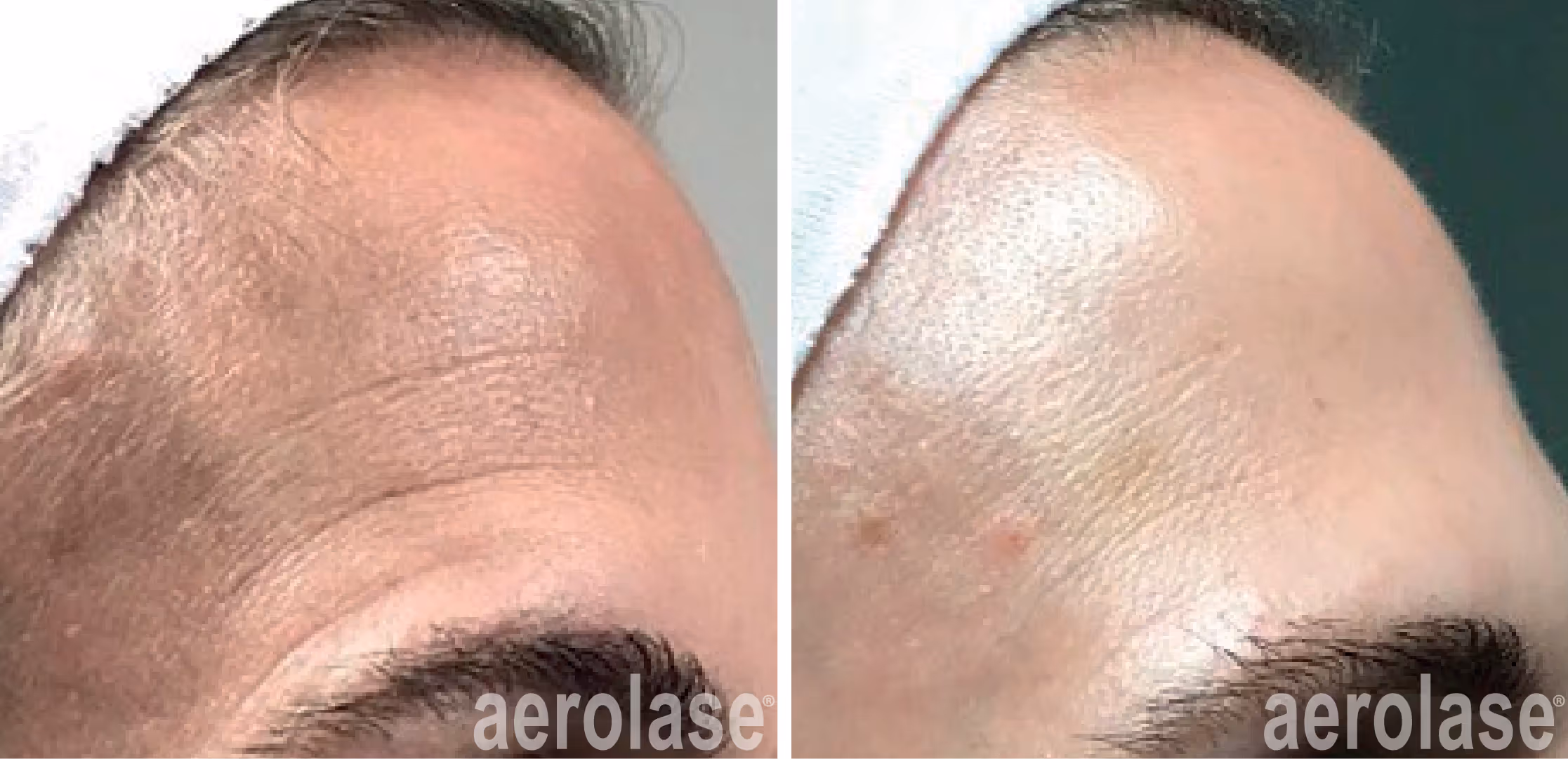 prevent and correct aging skin 101