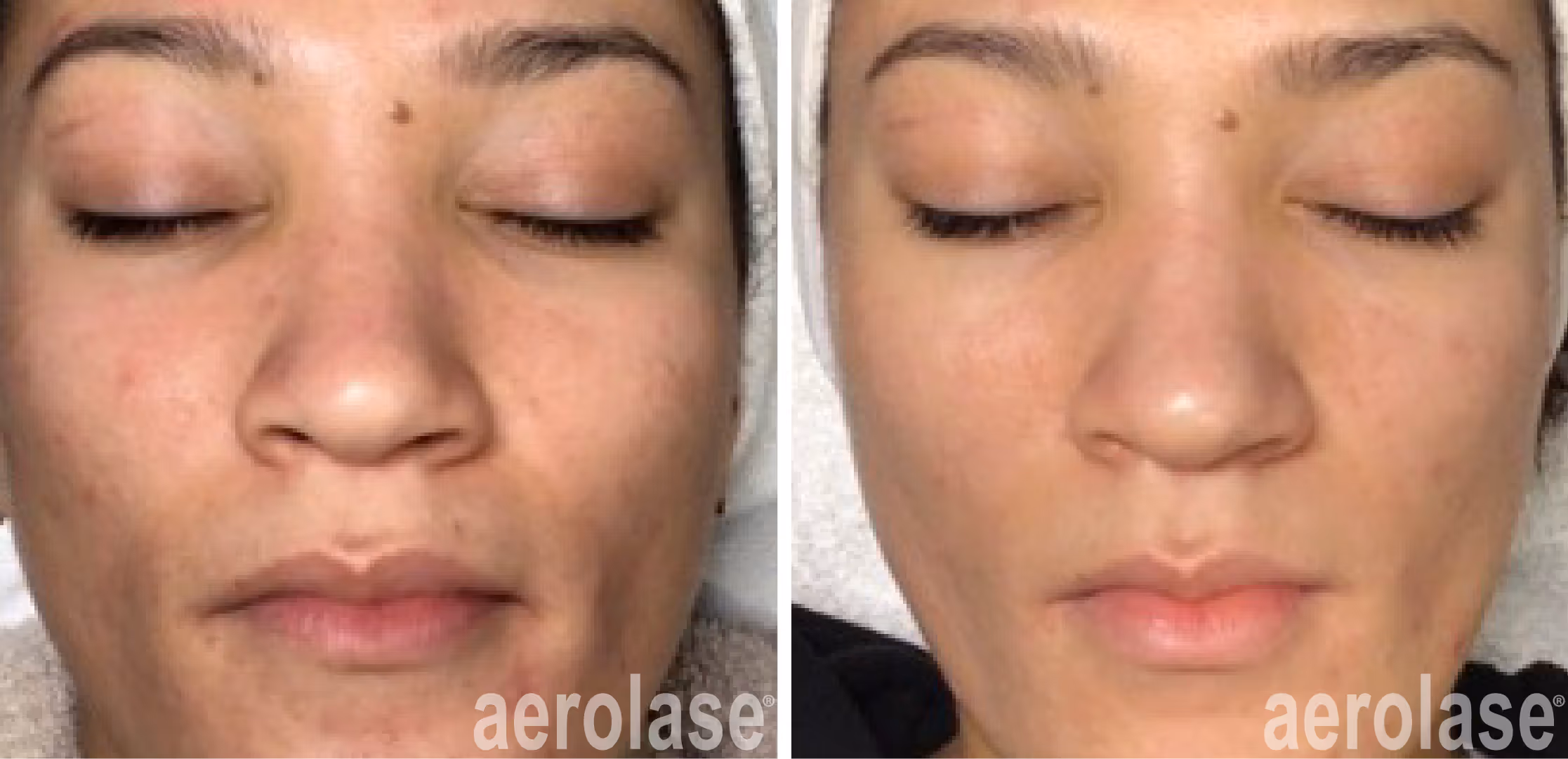 prevent and correct aging skin 101