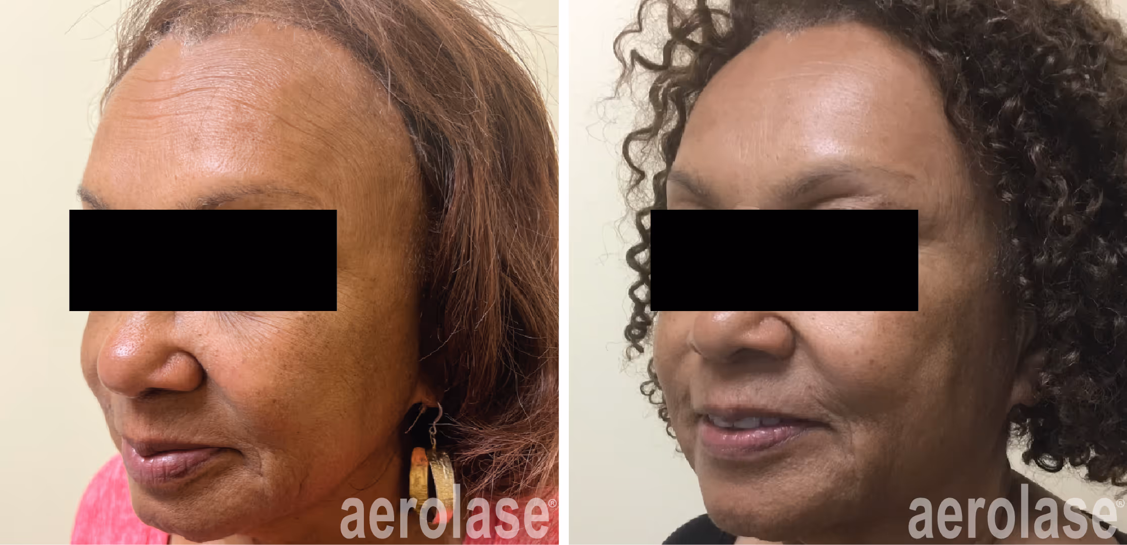 prevent and correct aging skin 101