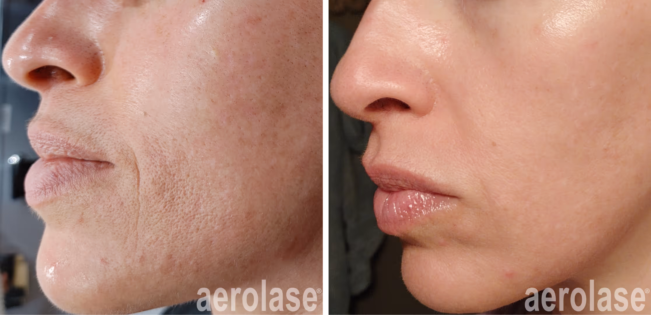 prevent and correct aging skin 101