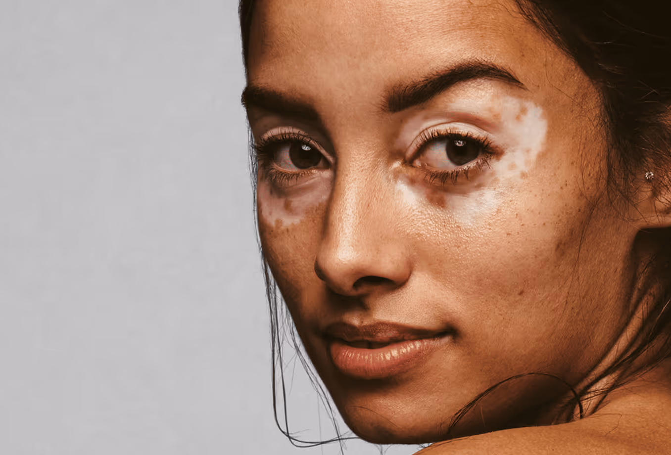 Le traitement Exci308 donne de l'espoir pour les maladies auto-immunes