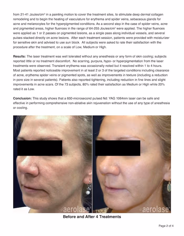 non ablative skin rejuvenation treatment with 650-microsecond laser