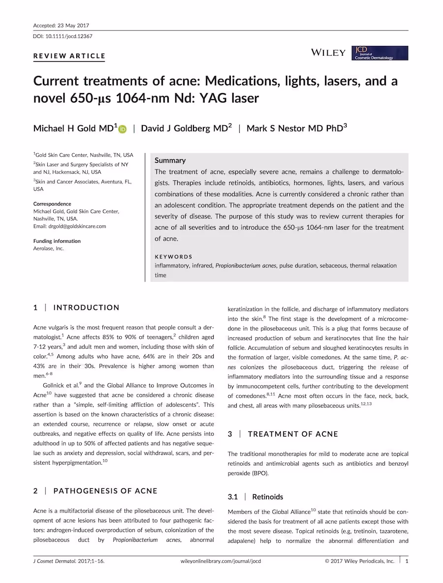 current treatments of acne and 650-microsecond laser