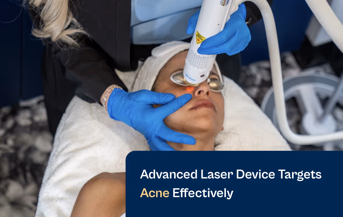 Aerolase Advanced Laser Device Targets Acne Effectively Blog