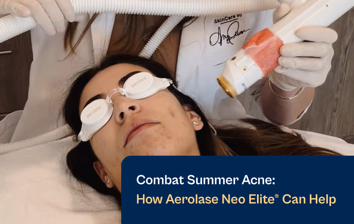 Aerolase Combat Summer Acne Blog