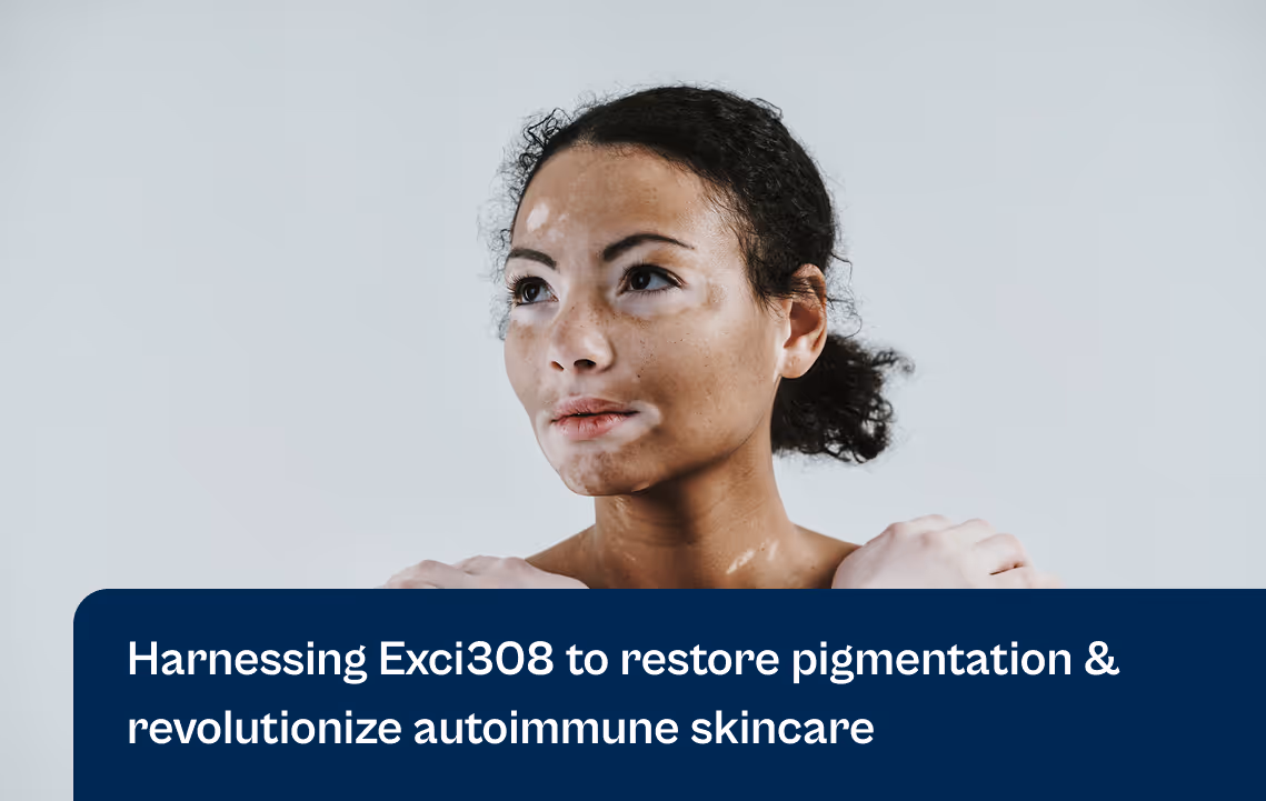 Exci308 d'Aerolase Restore Pigmentation Auto-immune Skin Care|Exci308 d'Aerolase Vitiligo Cheryl Burgess avant et après|Exci308 d'Aerolase Vitiligo Cheryl Burgess avant et après|Exci308 d'Aerolase Vitiligo Cheryl Burgess avant et après|Exci308 d'Aerolase Vitiligo Cheryl Burgess avant et après|Exci308 d'Aerolase Vitiligo Cheryl Burgess avant et après|Exci308 d'Aerolase Vitiligo Cheryl Burgess avant et après|Exci308 d'Aerolase Vitiligo Cheryl Burgess avant et après-Après|Exci308 d'Aerolase Vitiligo Cheryl Burgess Avant et après||||||Exci308 d'Aerolase Restore Pigmentation Autoimmune Skin Care|Exci308 de Aerolase Restore Pigmentation Auto-immune Skin Care |Exci308 de Aerolase Restore Pigmentation Autoimmune Skin Care|Exci308 de Soins auto-immuns pour la peau Aerolase Restore Pigmentation|Exci308 par Aerolase Restore Pigmentation Soins auto-immuns pour la peau | Exci308 par Aerolase Restore Pigmentation | Exci308 par Aerolase Restore Pigmentation Soins auto-immuns pour la peau | Exci308 par Aerolase Vitiligo Cheryl Burgess avant et après