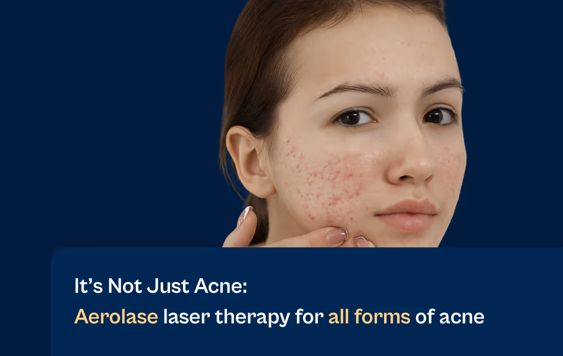 Aerolase Neo Elite Laser Therapy for All Forms of Acne|||||||||||||||||||||||||||||||||||||Aerolase Neo Elite Laser Therapy for All Forms of Acne|Aerolase Neo Elite Laser Therapy for All Forms of Acne|Aerolase Neo Elite Laser Therapy for All Forms of Acne|Aerolase Neo Elite Laser Therapy for All Forms of Acne|Aerolase Neo Elite Laser Therapy for All Forms of Acne|Aerolase Neo Elite Laser Therapy for All Forms of Acne|||||||||||||||||||||