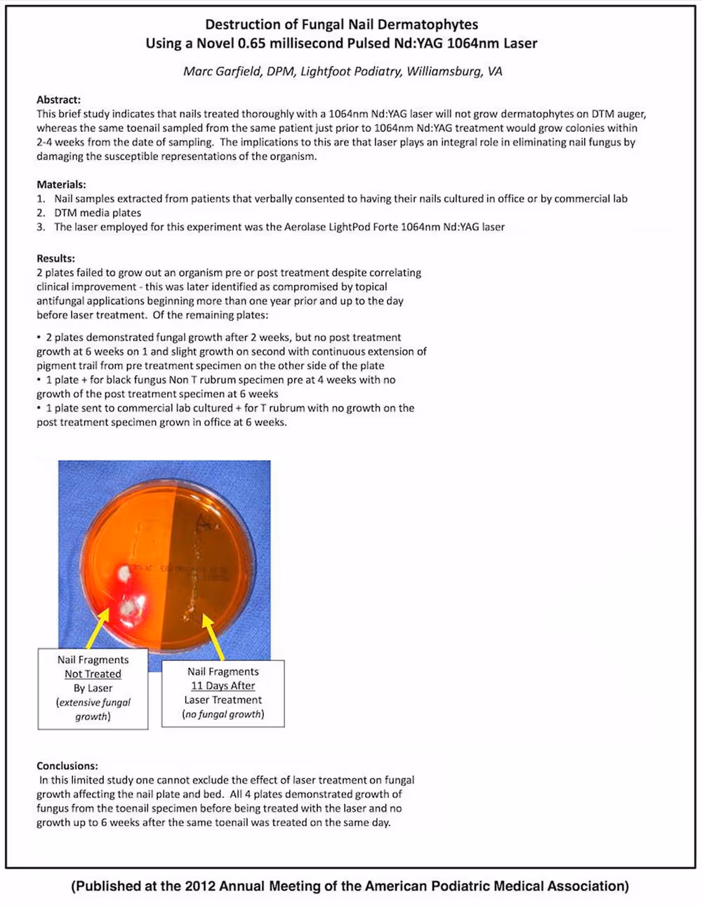 destruction of fungal nail dermatophytes using 650-microsecond laser