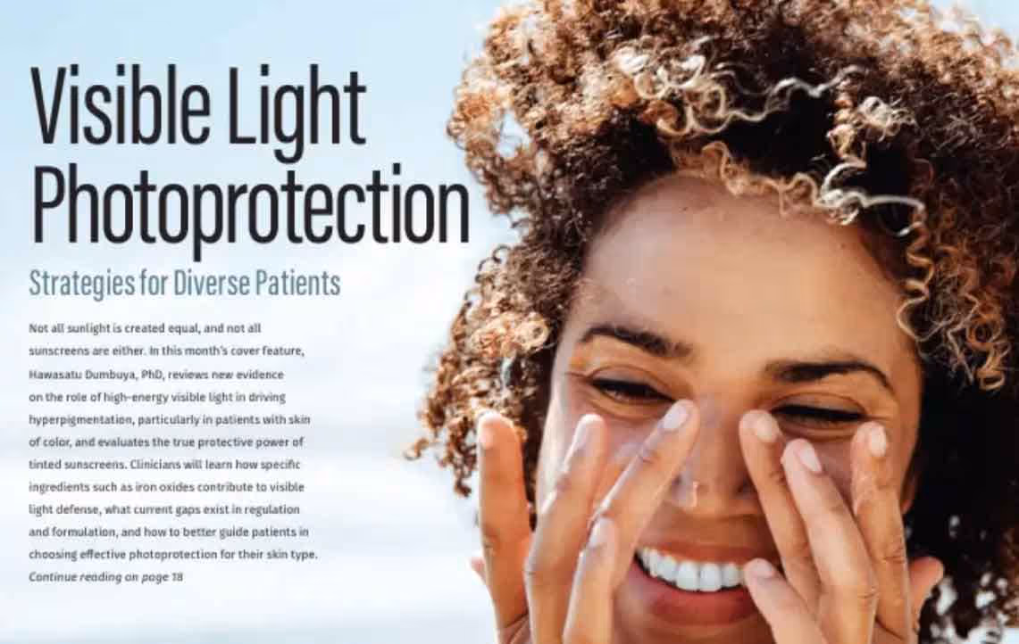 optimizing acne care in the summer with advanced laser technologies like Aerolase