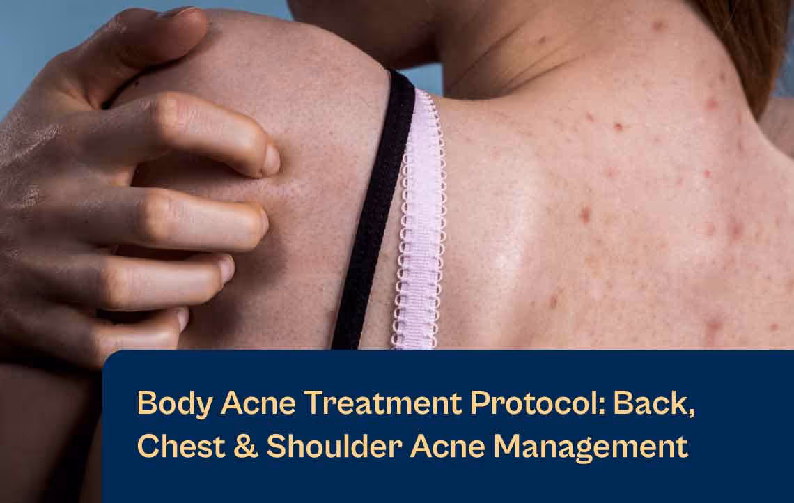 Protocollo di trattamento dell'acne corporea con laser Aerolase