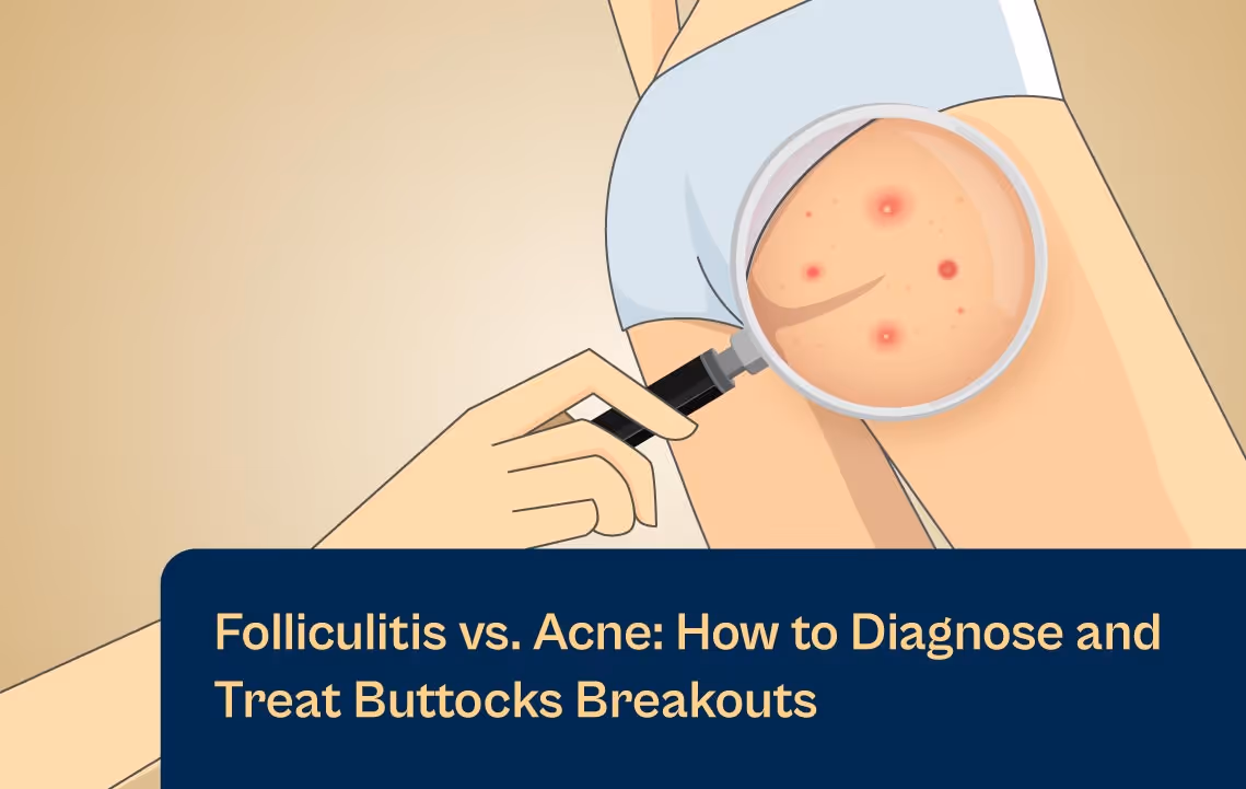 Come diagnosticare e trattare le eruzioni cutanee con il laser Aerolase Neo