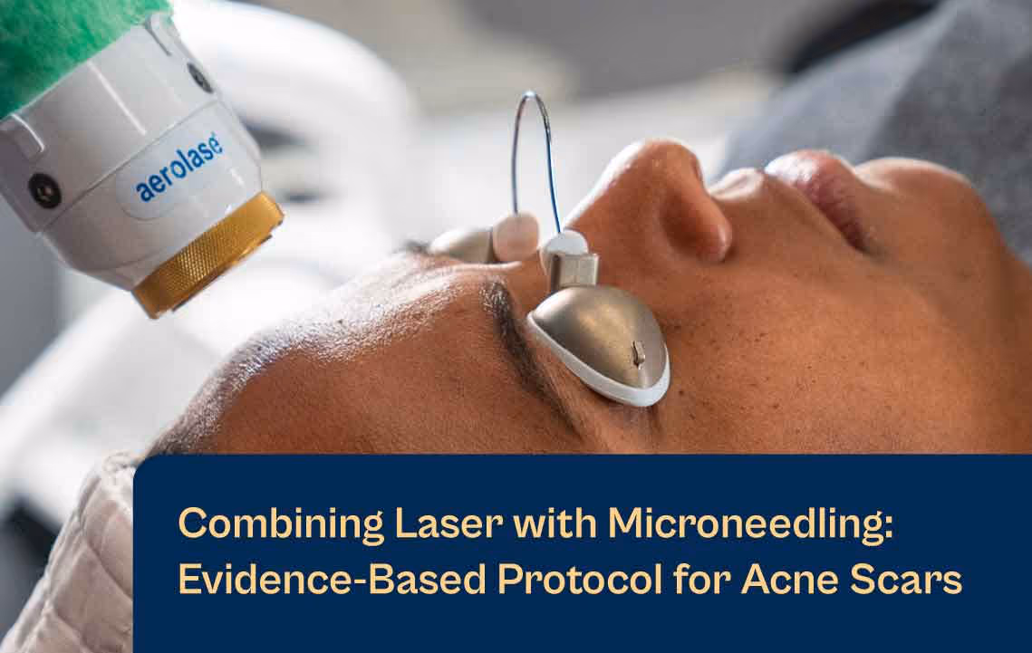 Blog sulla combinazione del laser Aerolase con il microneedling: protocollo basato sull'evidenza per le cicatrici da acne
