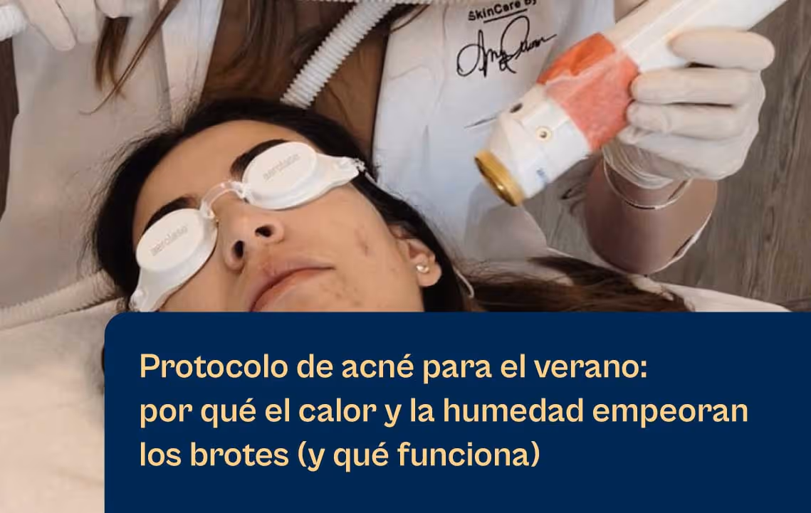 Aerolase Combat Summer Acné Blog