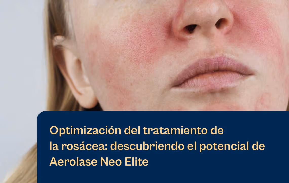 Aerolase optimiza el tratamiento de la rosácea y revela el potencial del blog Aerolase Neo Elite