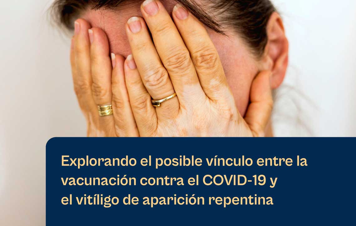 Exci308 de Aerolase para tratar el vitíligo