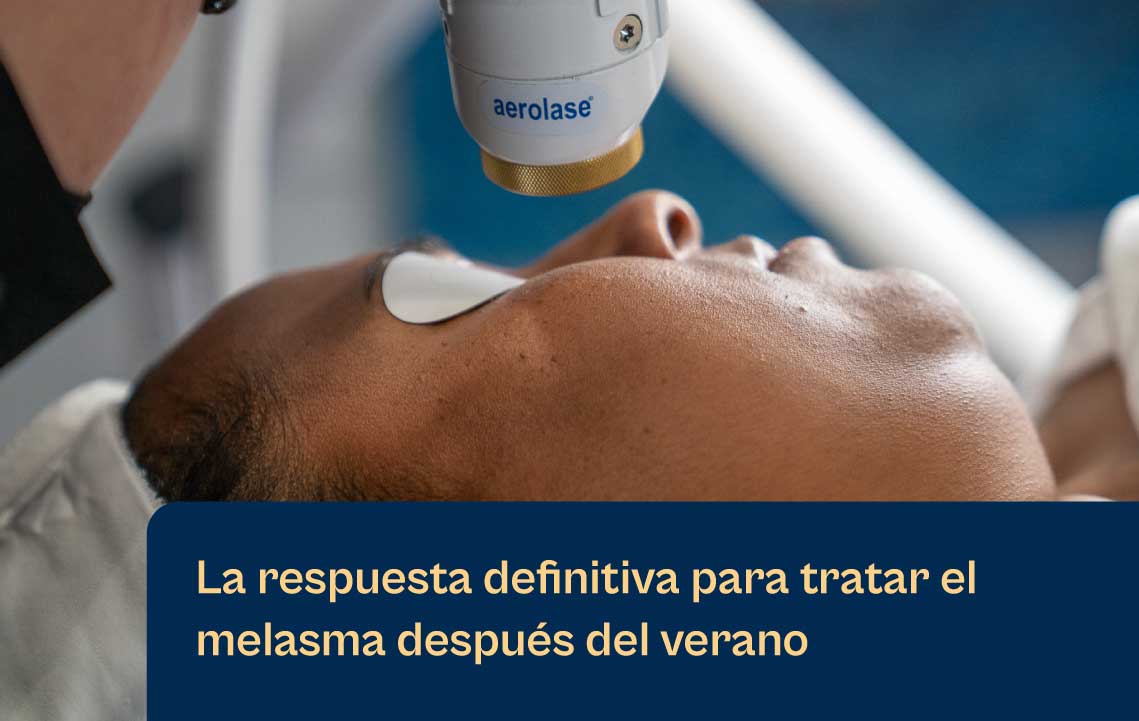 Aerolase Neo Elite: la respuesta definitiva al melasma cuando el verano llega a su fin