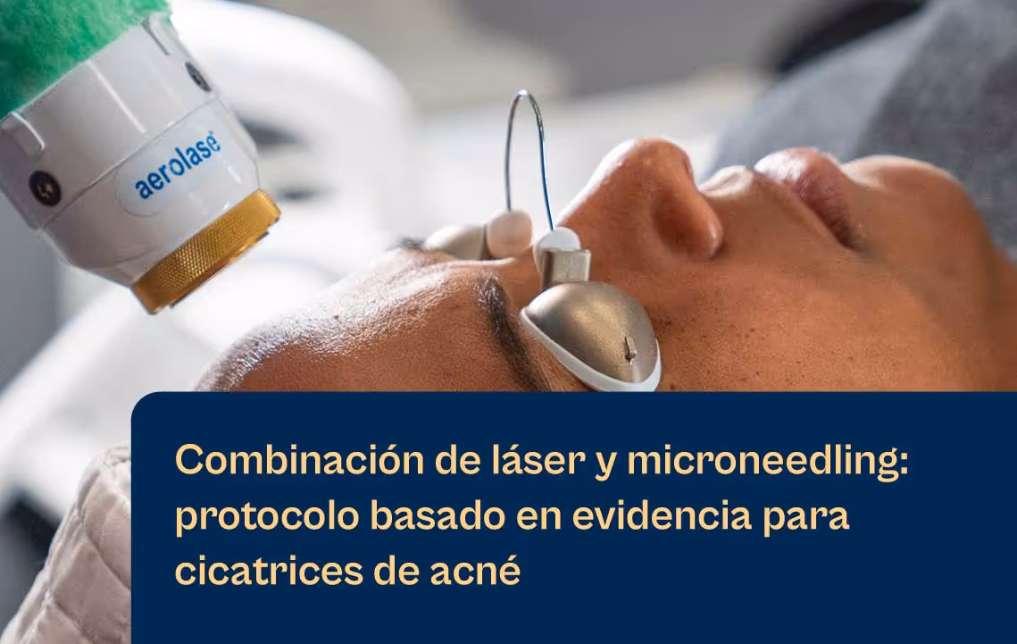 Combinación del láser Aerolase con microagujas: blog sobre el protocolo basado en la evidencia para las cicatrices del acné