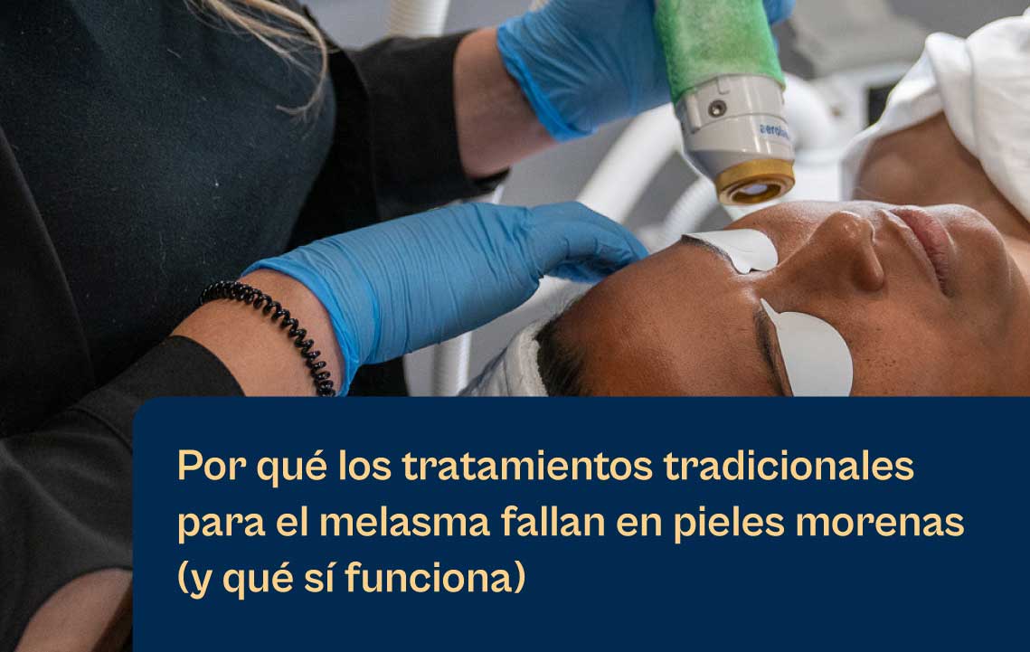 Aerolase El futuro del tratamiento del melasma: consiga resultados con Aerolase Neo Elite