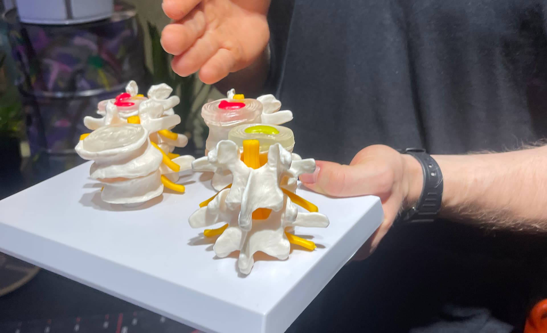 Джевага Володимир Валентинович демонструє анатомічну модель хребта з міжхребцевою грижею в DZHEVAHA GYM - наочне пояснення патології для кращого розуміння клієнтом проблеми та шляхів реабілітації