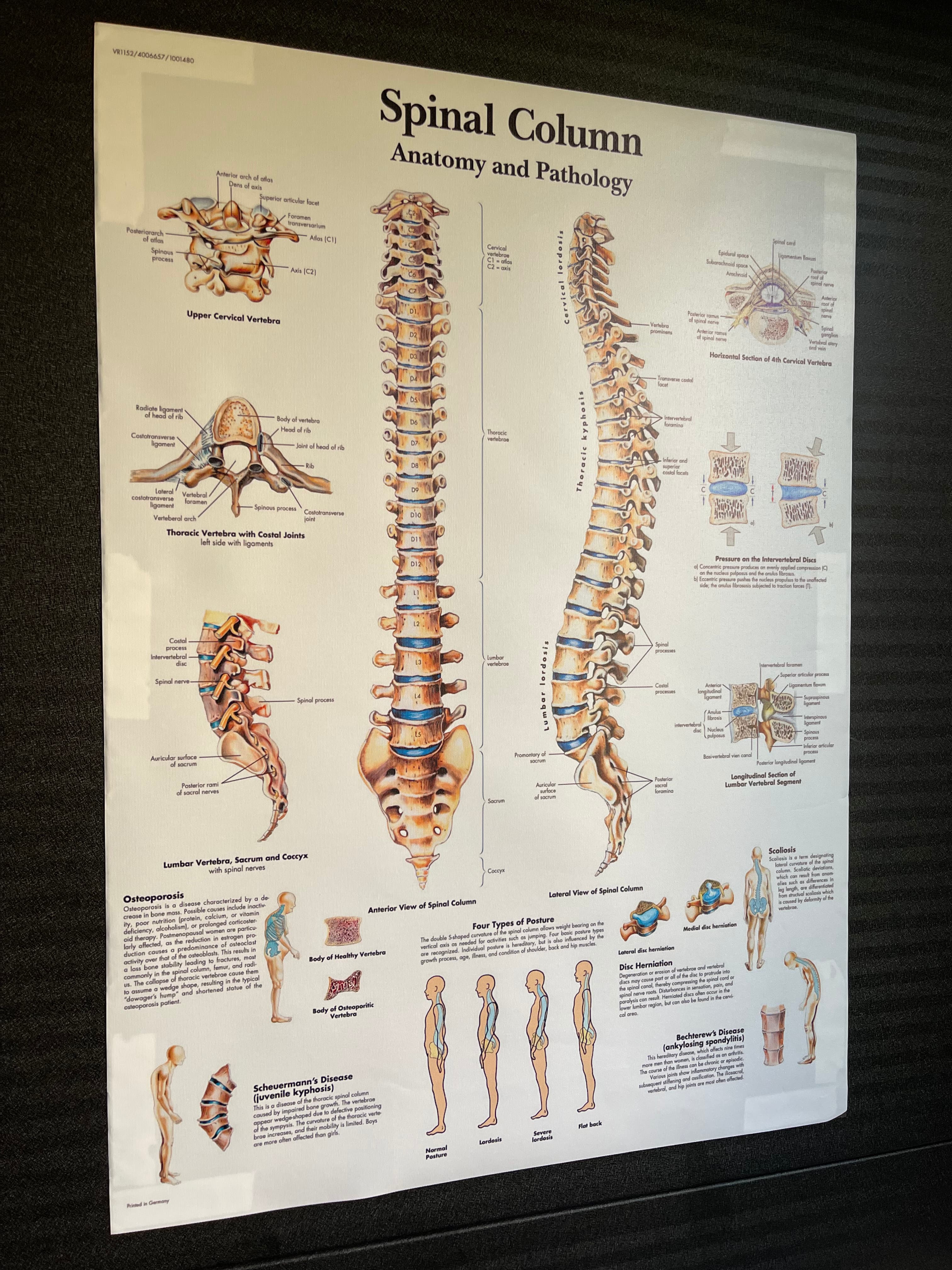 Ілюстративний анатомічний плакат хребта з детальним зображенням відділів: шийного, грудного, поперекового, крижів і куприка. На схемі представлені будова хребців, міжхребцеві диски, фізіологічні вигини, типи постави та поширені патології — сколіоз, кіфоз, лордоз, протрузії та грижі дисків.  Зображення використовується як візуальний матеріал до статей про здоров’я хребта, біомеханіку руху та причини болю в спині. Плакат допомагає зрозуміти анатомічну основу реабілітаційних програм, принципи розподілу навантаження на міжхребцеві диски та значення стабілізації корпусу.  Матеріал для розділу «Анатомія і патологія хребта» — Dzhevaha Gym, Київ, Осокорки.