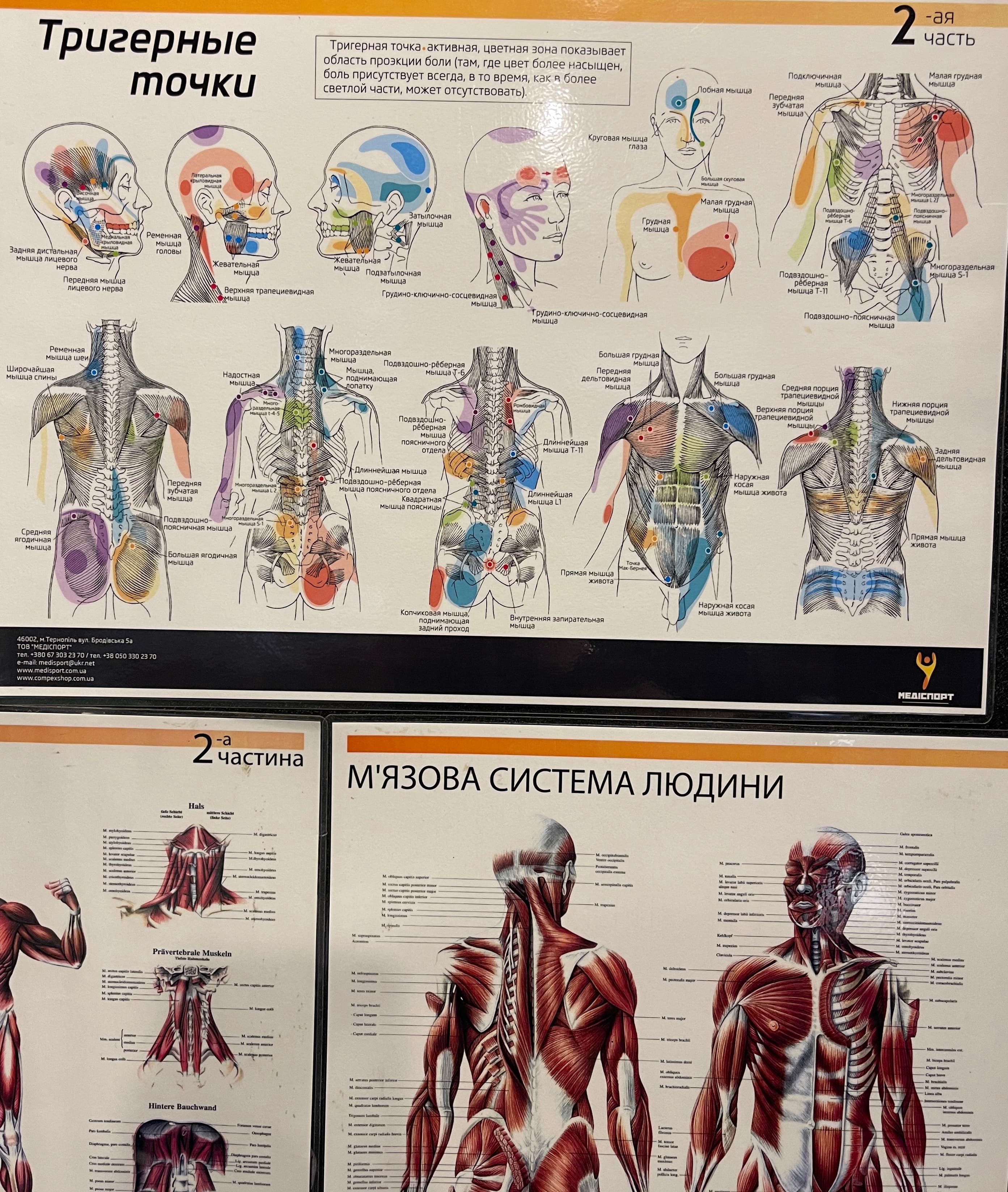 Біль у тілі не завжди виникає саме там, де ми його відчуваємо. Часто причина знаходиться зовсім в іншій ділянці. Це пов’язано з тим, що наше тіло працює як єдина система через фасціальні лінії — мережу сполучної тканини, яка з’єднує м’язи, сухожилля і різні частини тіла в один ланцюг. Коли в одній ділянці виникає напруга, укорочення або тригерна точка, ця напруга може передаватися по всьому фасціальному ланцюгу. У результаті людина відчуває, що «тягне» або болить в одному місці, хоча джерело проблеми знаходиться в іншому. Наприклад: • напруга в м’язах шиї може викликати головний біль • проблеми в сідничних м’язах можуть віддавати в поперек • жорсткі грудні м’язи часто провокують біль між лопатками Саме тому у відновленні важливо працювати не тільки з місцем болю, а з усім руховим ланцюгом: міофасціальний реліз, мобільність, розтягнення і вправи на стабілізацію допомагають відновити баланс напруги в тілі. Коли фасції рухаються вільно, а м’язи працюють узгоджено — біль зменшується, а рух стає легшим і природнішим.
