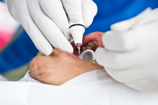 acido-tranexamico-indicacoes-e-aplicacoes