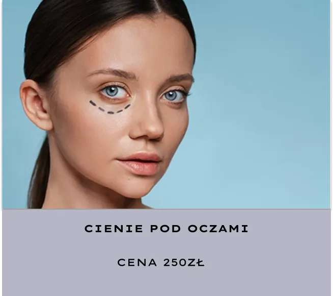 Cienie pod oczami