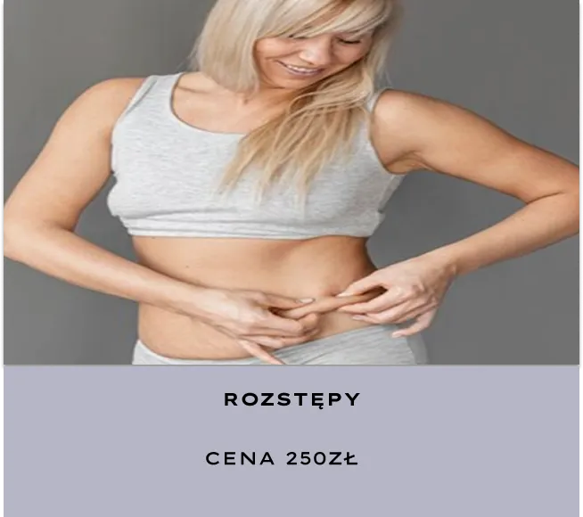 Rozstępy