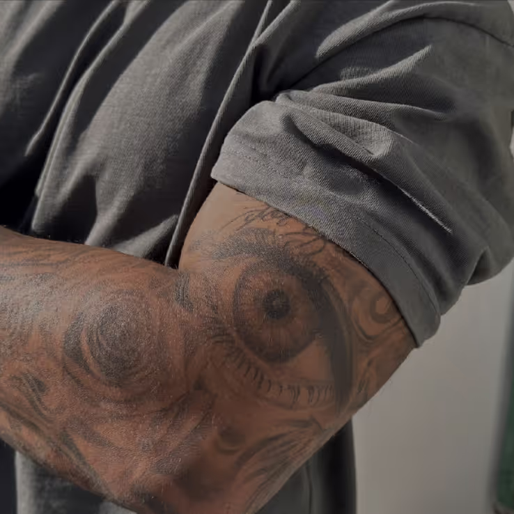 photo of an arm 