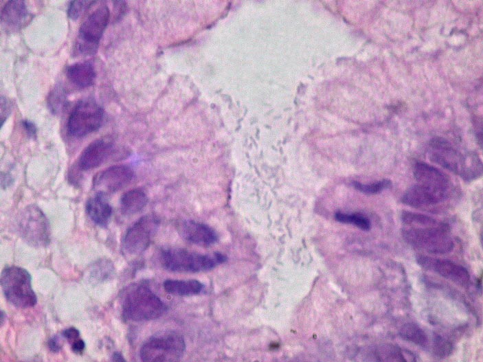 An image of cells under a microscope. Purple fragmented cells are split across the display.