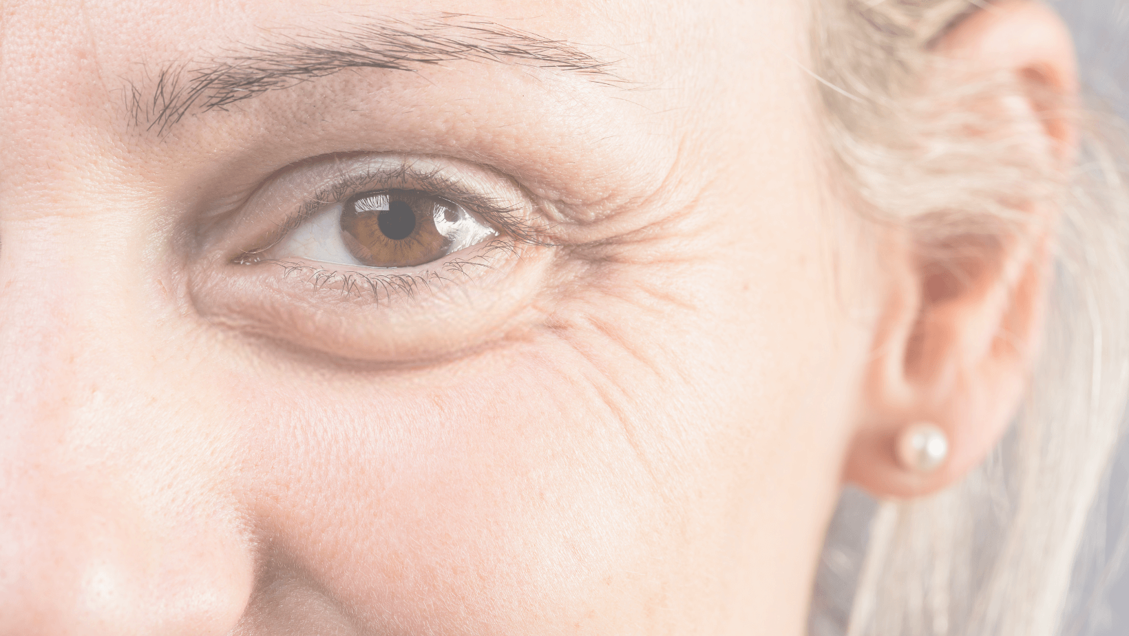 Soft neutral Skóra Skin Aesthetics blog cover for a Botox article