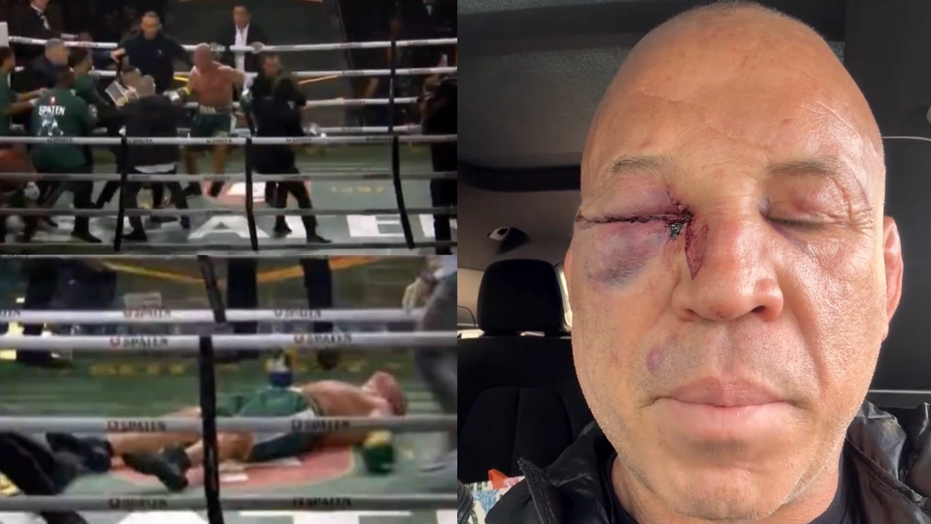 La légende du MMA Wanderlei Silva blessée après un KO lors d’une bagarre générale