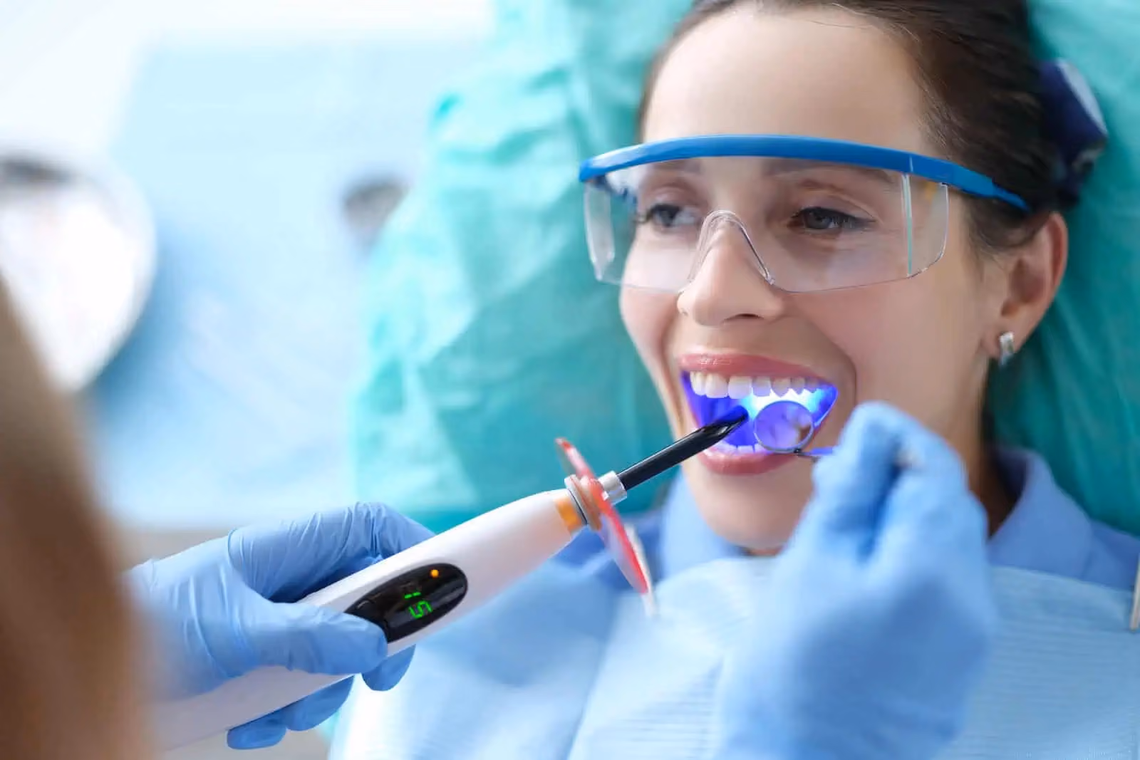 Dental Bonding