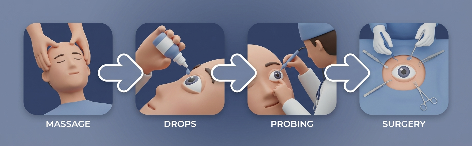 Treatment pathway showing massage, drops, probing, and surgery in a stepwise 3D strip
