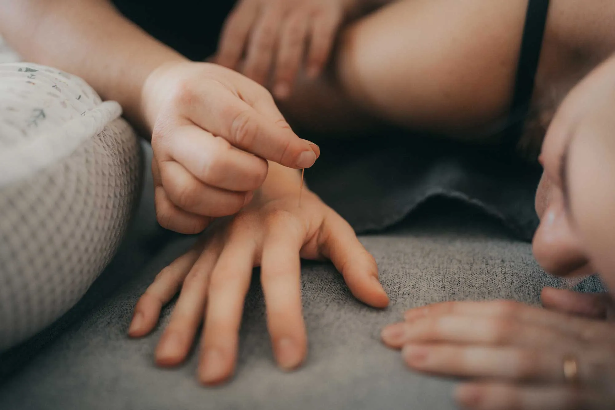 Akupunkturnadel wird in die Hand einer liegenden Person gesetzt