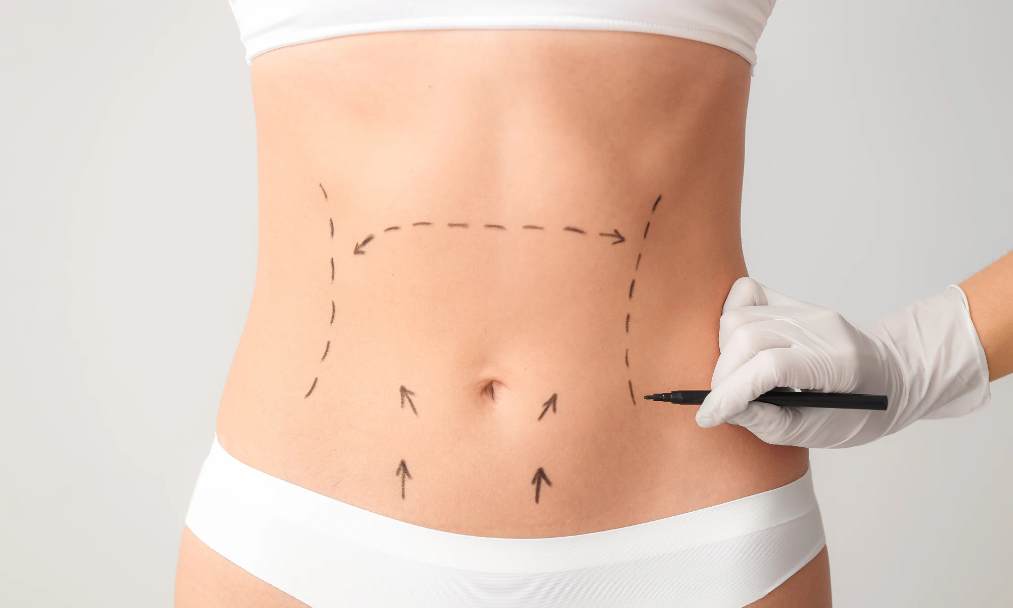  9 Best UK SEO Agencies for Cosmetic Surgeons (2025)