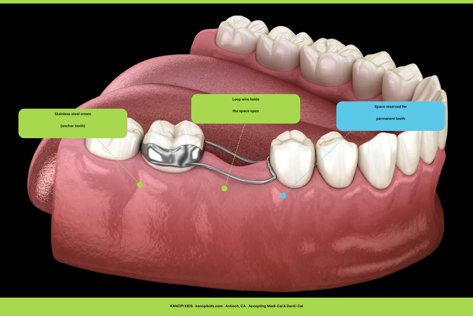 blog image 2