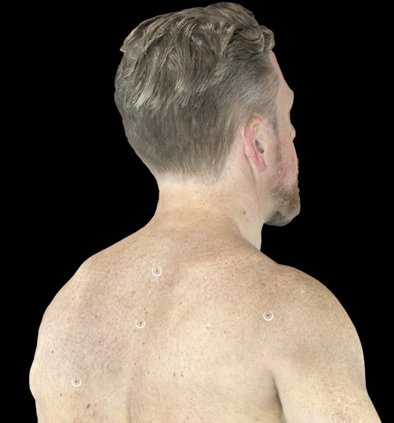 OptimaScan DermEngine skin check imaging system with detection overlay