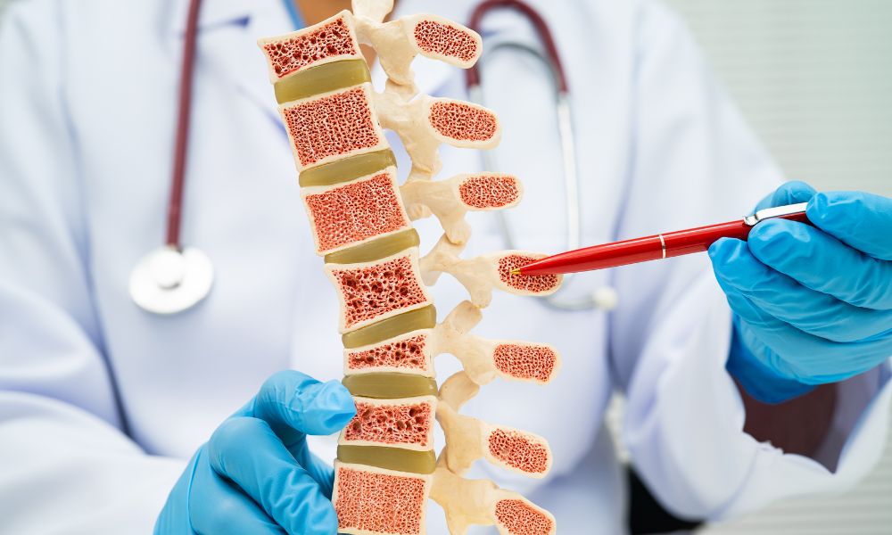 Osteoporosis Prevention