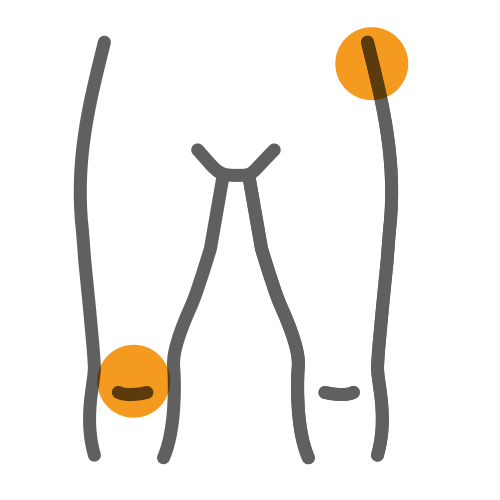 Simple illustration of a human lower body highlighting the hip on the right side and the left knee with orange circles.
