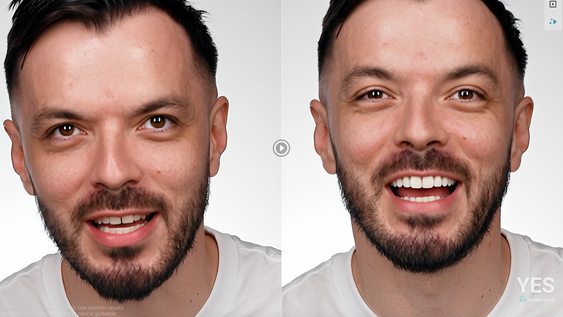 Introducing Smilecloud YES