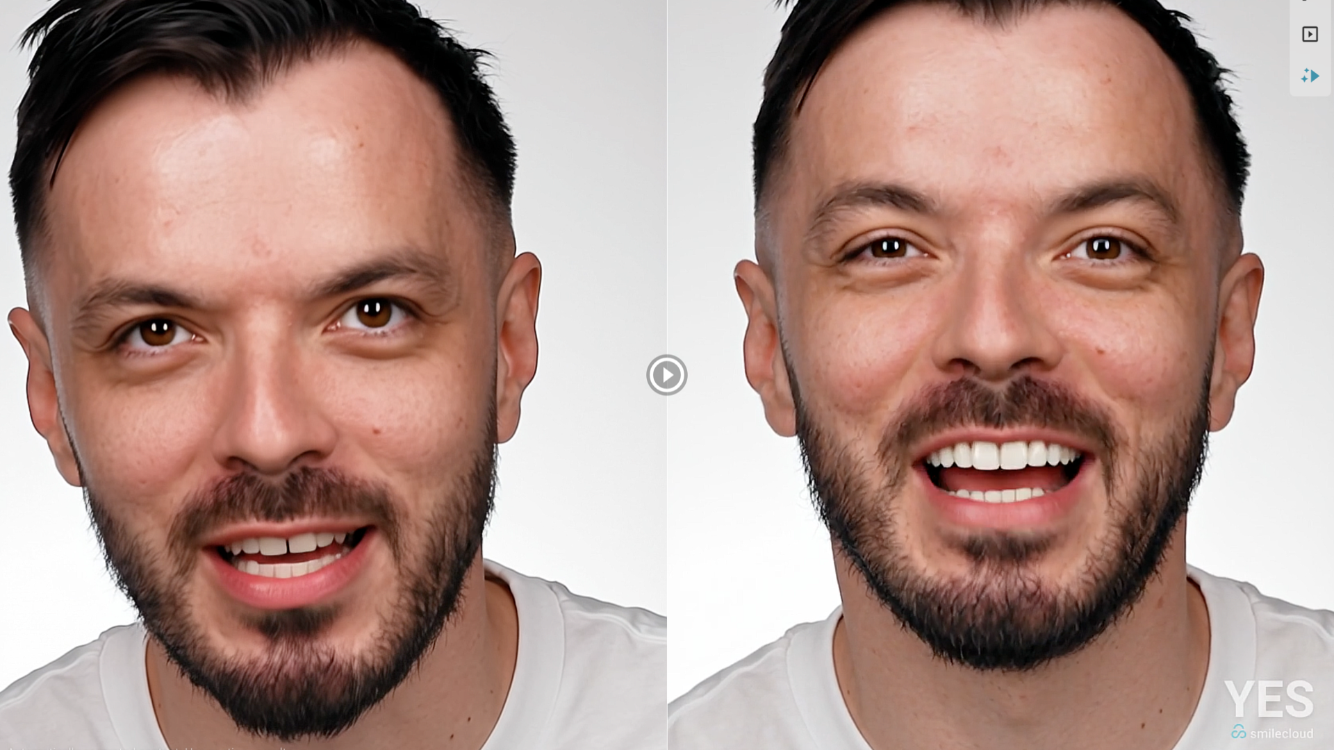 Introducing Smilecloud YES