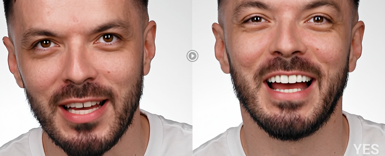 Introducing Smilecloud YES