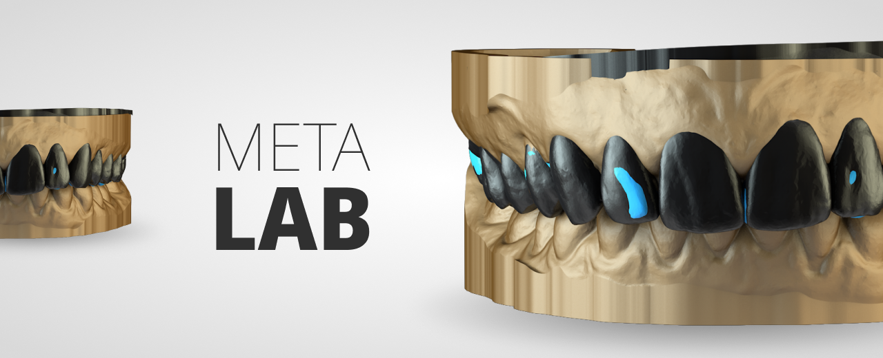 Metalab - Outsourcing Digital Designs